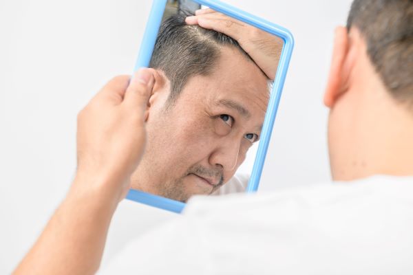 Hair Transplant Packages